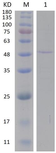 12% SDS-PAGE analysis profiles of purified PA1011-20-396 (CBB stained).
